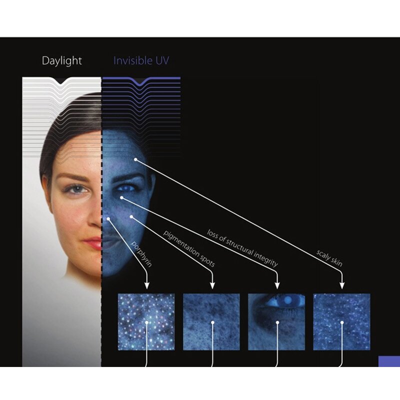 EMS Body Sculpting - Manufacturer - Portable Muscle Stimulant Machine