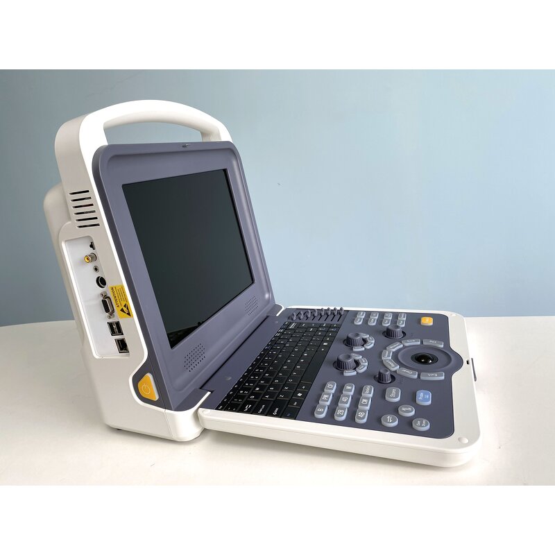 Gynecology Ultrasound Scanner - Manufacturer - Smart Color Doppler Clinic Use