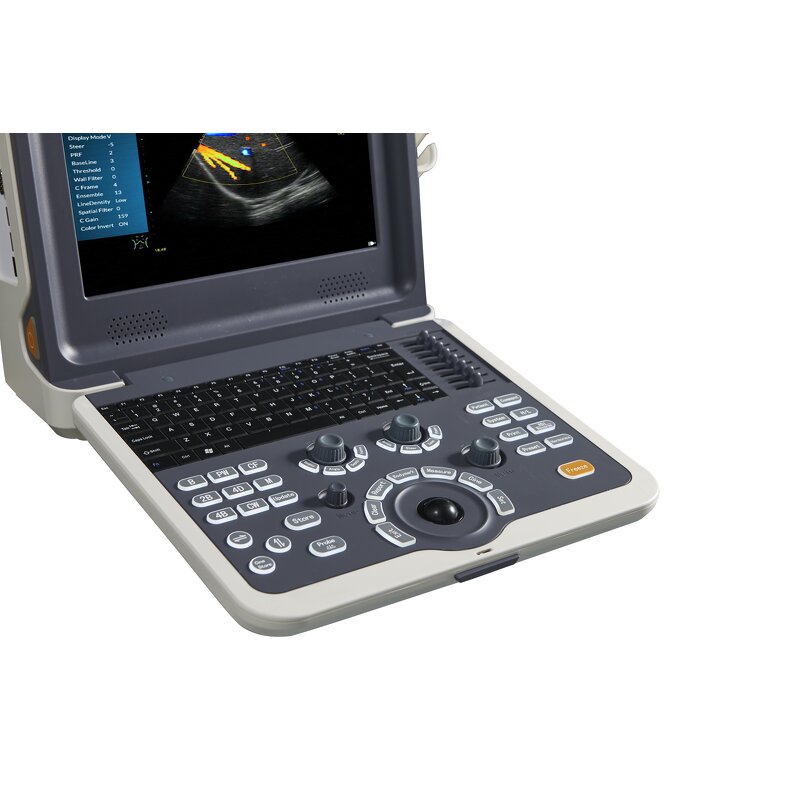 Gynecology Ultrasound Scanner - Manufacturer - Smart Color Doppler Clinic Use