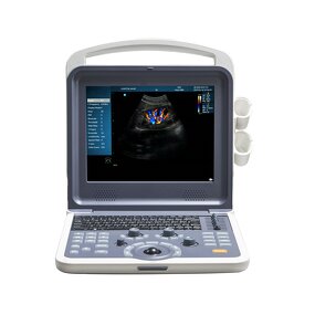 Cardiac Ultrasound Scanner - Manufacturer - 3D 4D Portable Color Doppler Machine