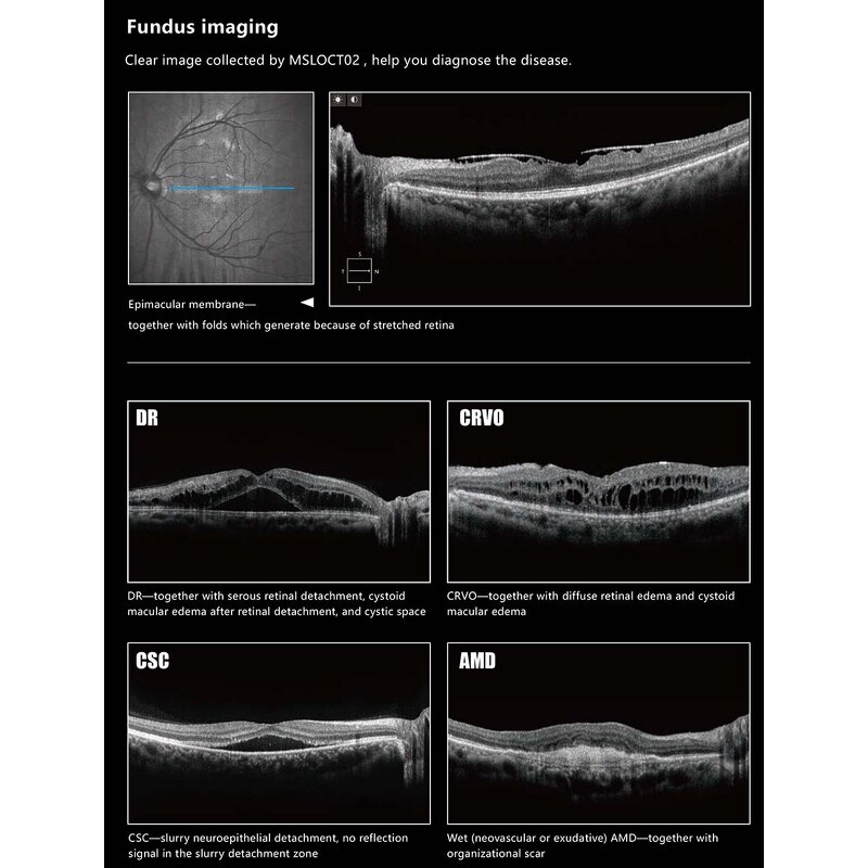 Veterinary Slit Lamp - Manufacturer - Portable Handheld Ophthalmic Vet Equipment