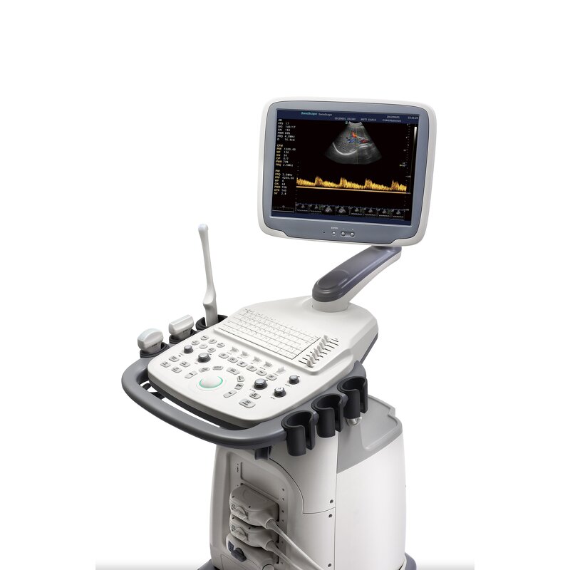 Trolley Ultrasound System - Manufacturer - S11 15 Inch LCD 3D 4D Color Doppler