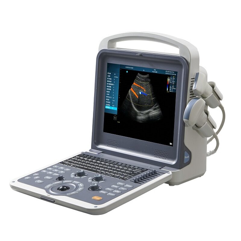 Gynecology Ultrasound Scanner - Manufacturer - Smart Color Doppler Clinic Use