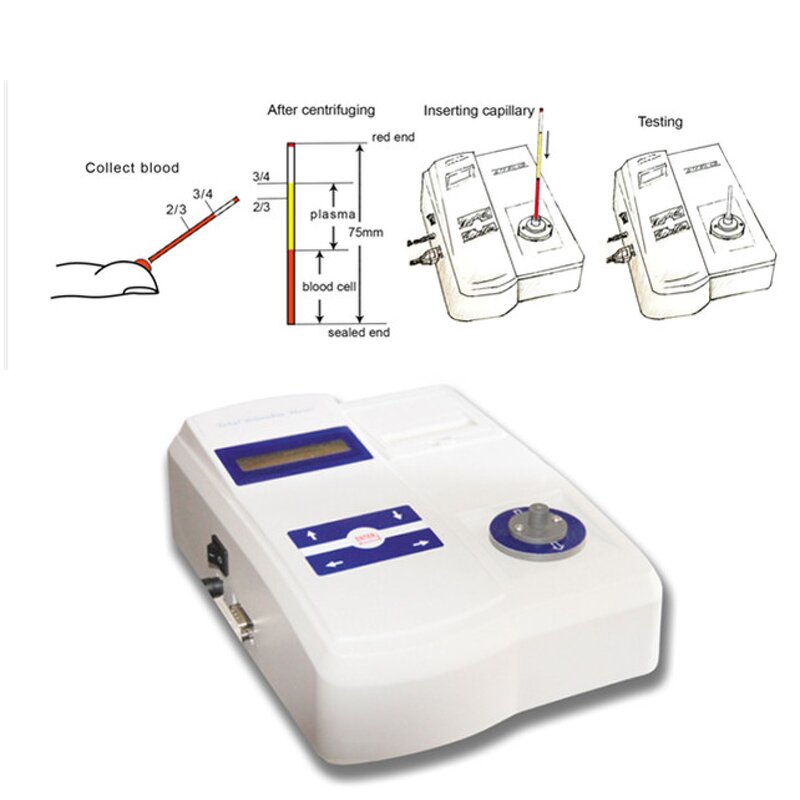 Bilirubin Meter - Manufacturer - Medical Direct Photometric for Newborn Baby