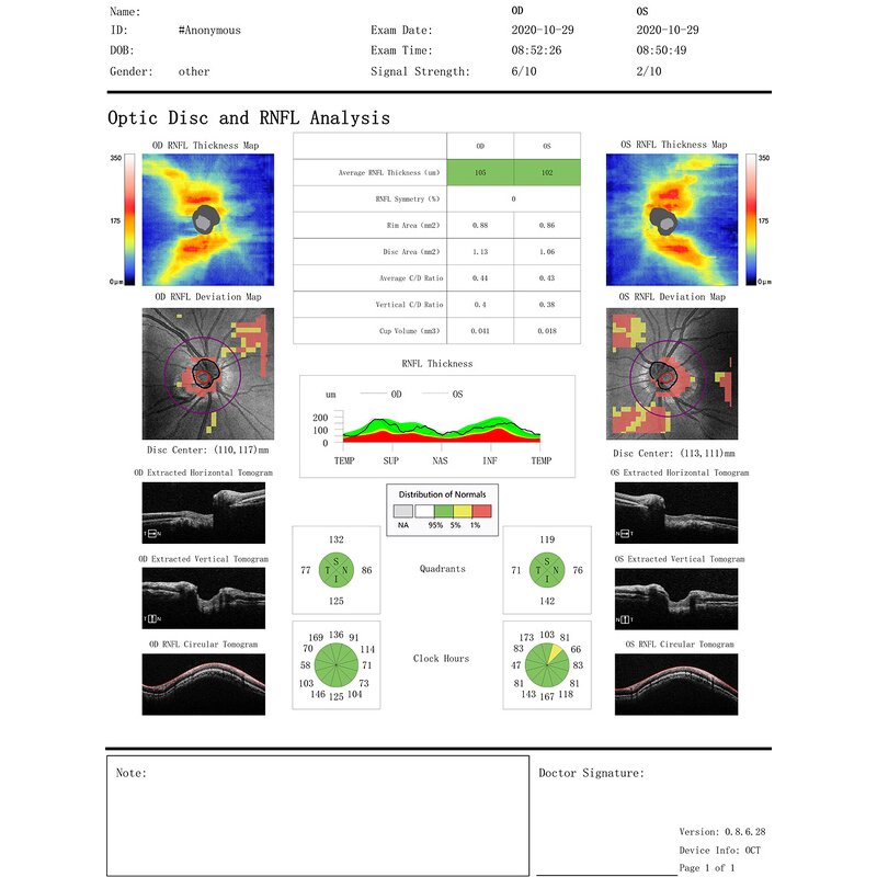 Handheld Slit Lamp - Manufacturer - Ophthalmic Portable Glare Test Equipment