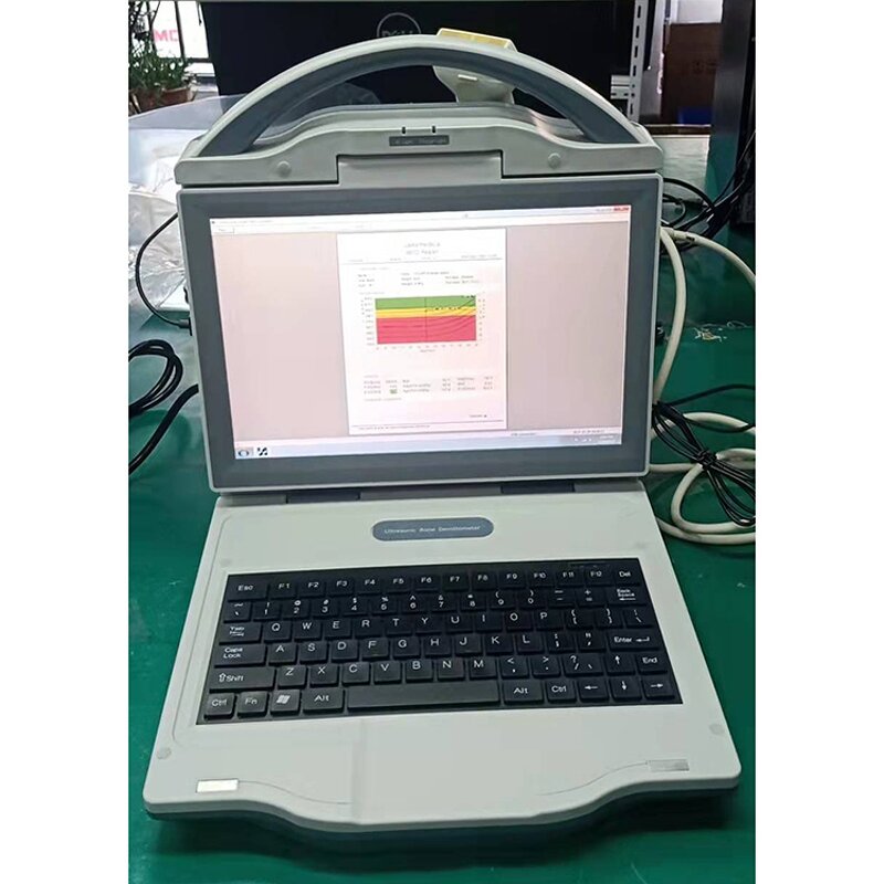 Ultrasound Bone Densitometer - Manufacturer - Automatic Portable Color Diagnostic