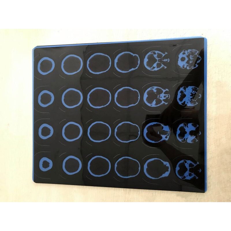 Xray Thermal Printer - Manufacturer - MSLDY03 Clear Image for DR System Medical