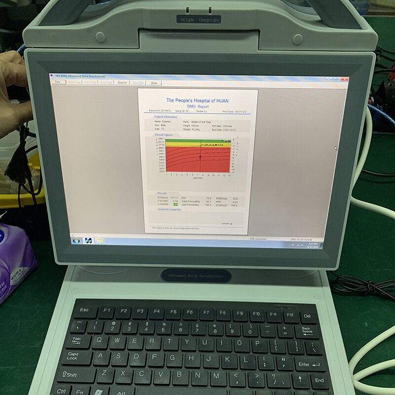 Ultrasound Bone Densitometer - Manufacturer - Automatic Portable Color Diagnostic