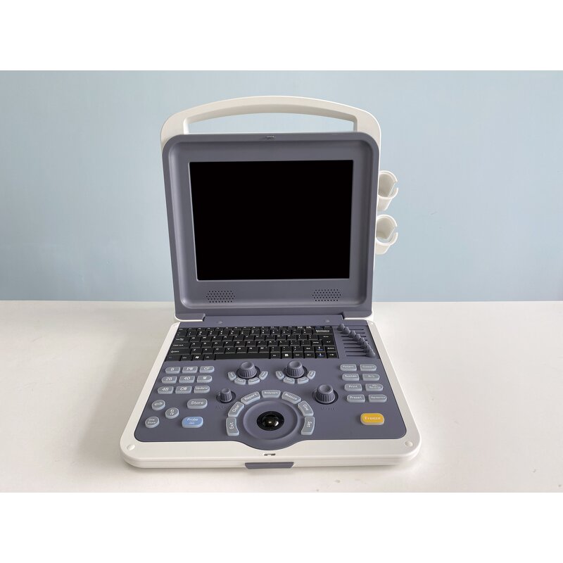 Gynecology Ultrasound Scanner - Manufacturer - Smart Color Doppler Clinic Use