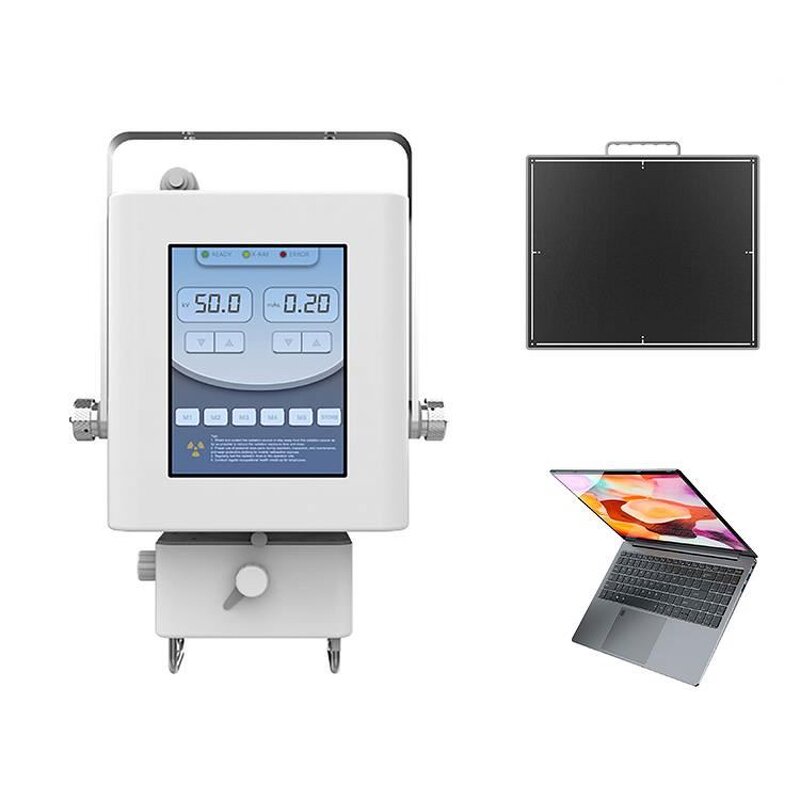 Digital X-ray Machine - Manufacturer - 5kw 9.7 Inch Touch Screen Iray Portable Radiology