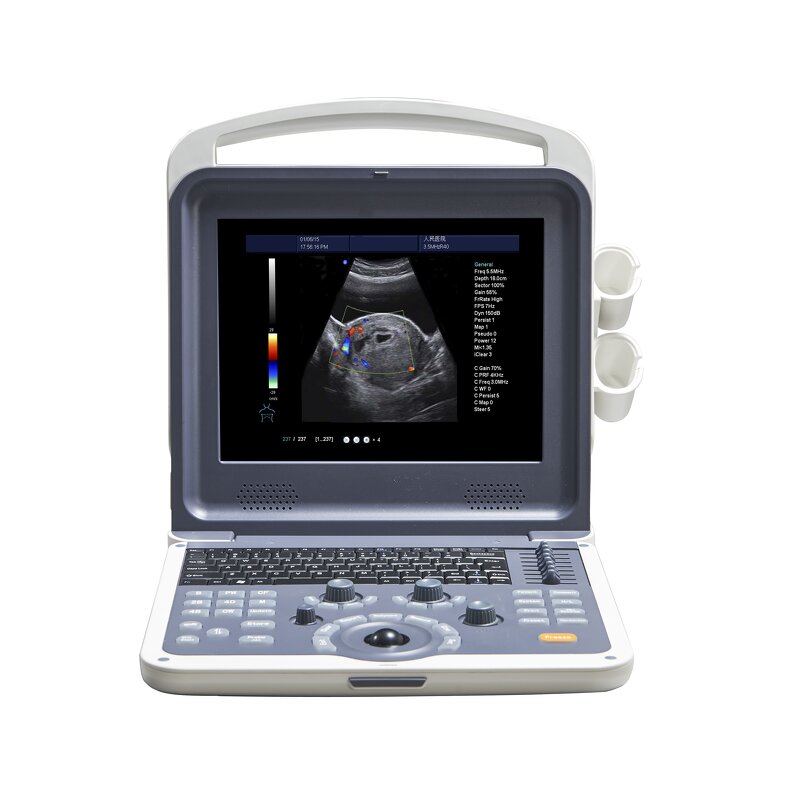 Color Doppler Ultrasound - Manufacturer - MSLCU28 High Resolution Tissue Imaging