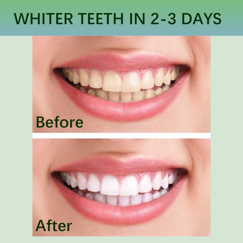 Whitening Strips Supplier - OEM Wholesale Dental Tooth Whitener Gel Strips