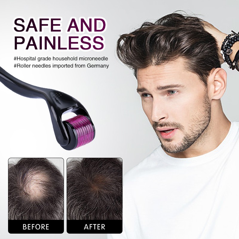 Derma Roller Supplier - OEM Microneedle Roller Beard Growth Hair Tool