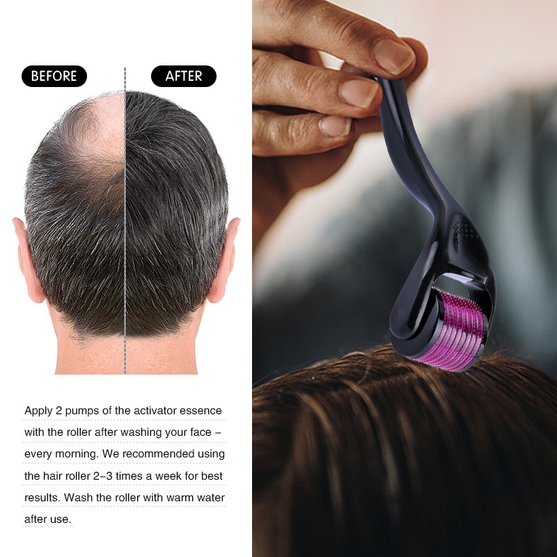 Derma Roller Supplier - OEM Microneedle Roller Beard Growth Hair Tool