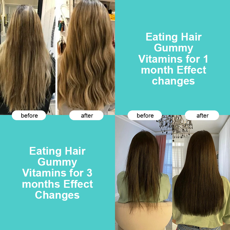 Hair Growth Gummies Manufacturer - Private Label Organic Biotin Zinc Multivitamin