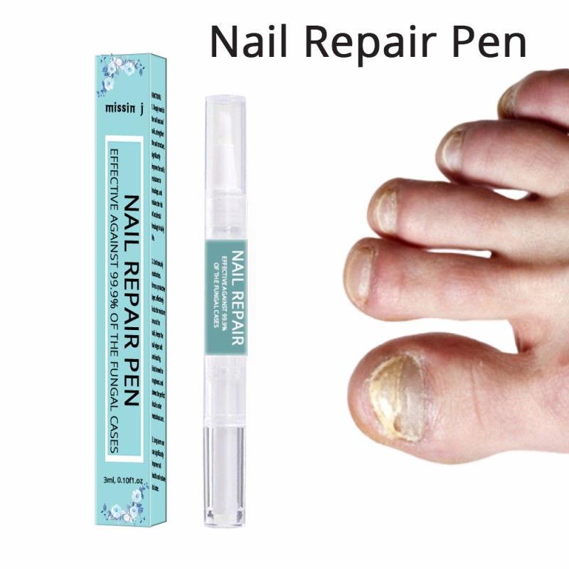 Nail Fungus Treatment Pen Factory - Anti Fungal Repair Private