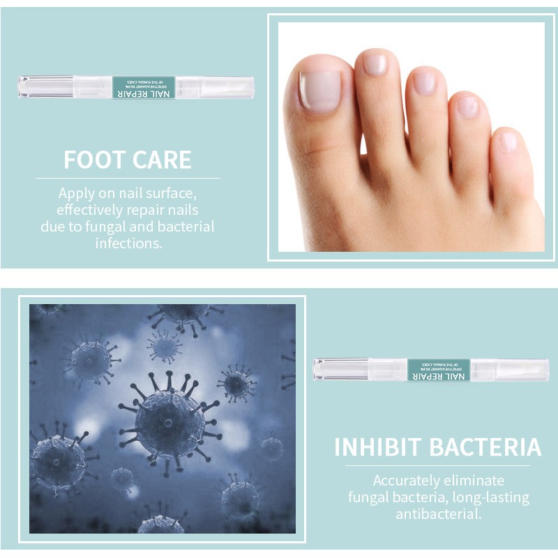 Nail Fungus Treatment Pen Factory - Anti Fungal Repair Private