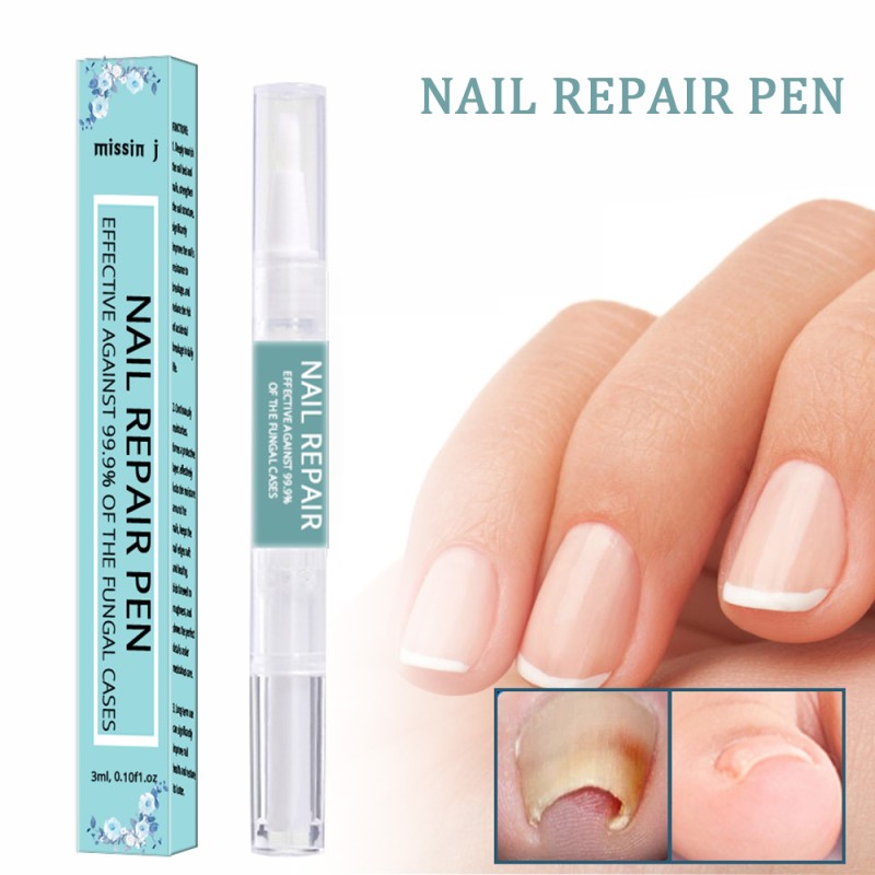 Nail Fungus Treatment Pen Factory - Anti Fungal Repair Private