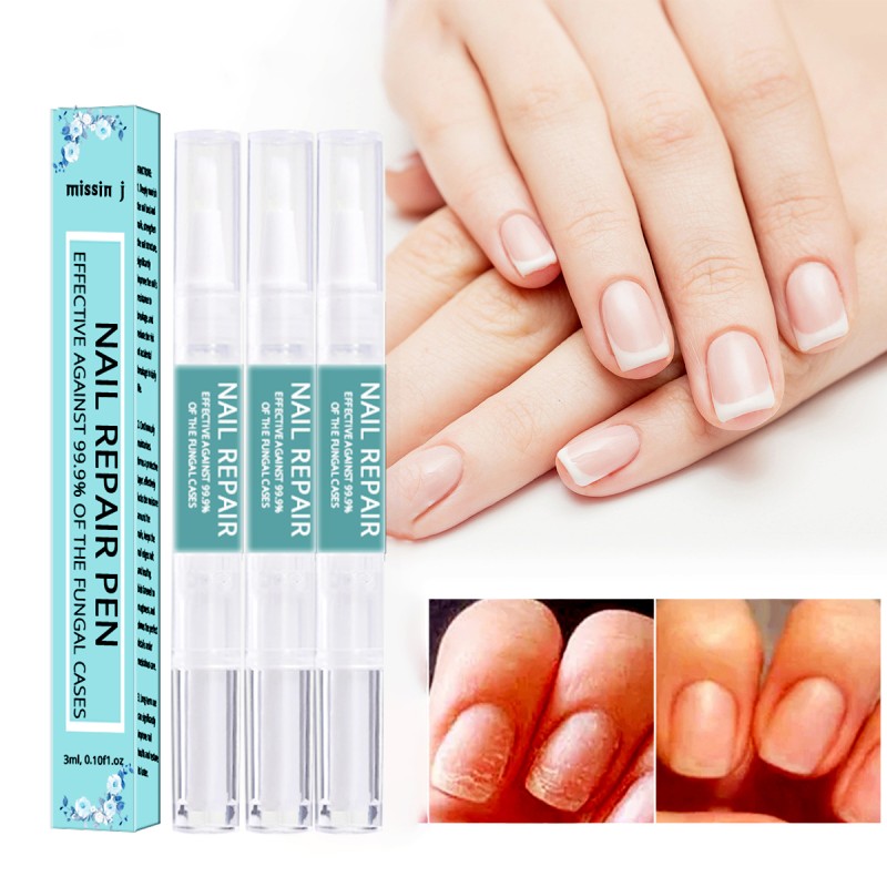 Nail Fungus Treatment Pen Factory - Anti Fungal Repair Private