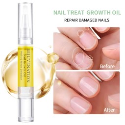 Nail Growth Oil Supplier - Custom Rejuvenation Instant Repair