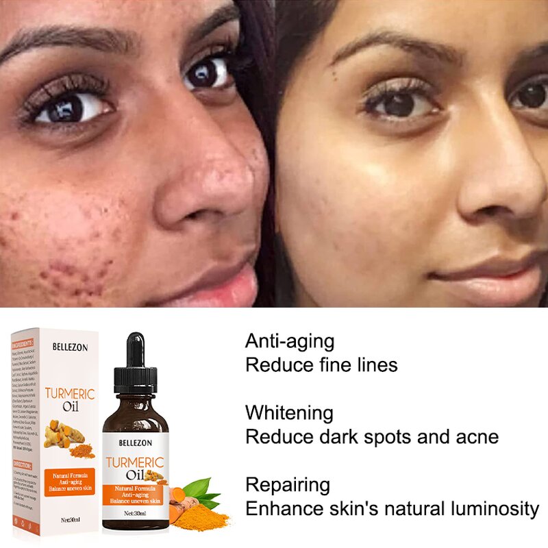 Turmeric Face Oil Manufacturer - Purifying Reduce Redness Improve Skin Tone
