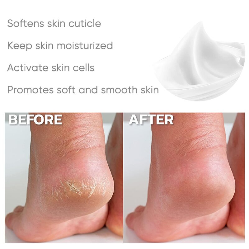 Urea Cream Manufacturer - Hydrating Softening Exfoliating Repairing Dry Rough Callused Skin