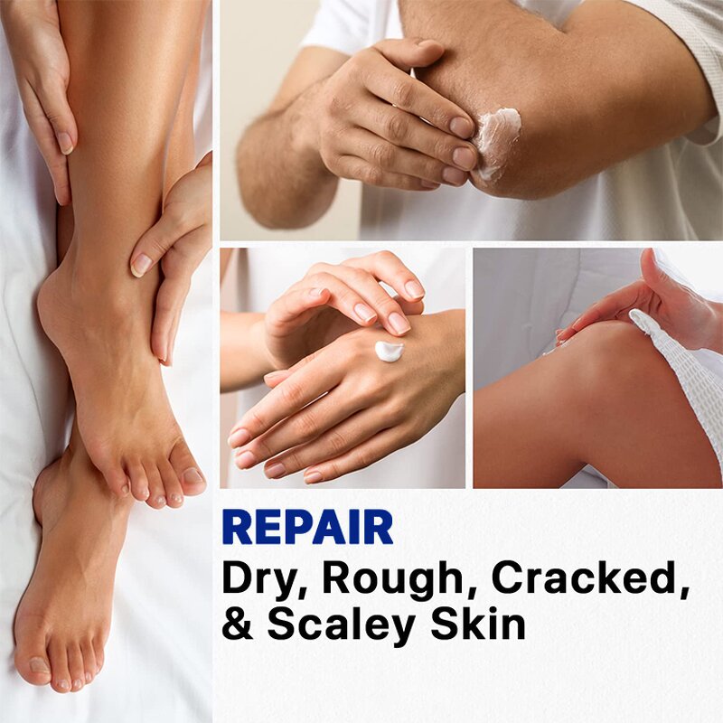 Urea Cream Manufacturer - Hydrating Softening Exfoliating Repairing Dry Rough Callused Skin