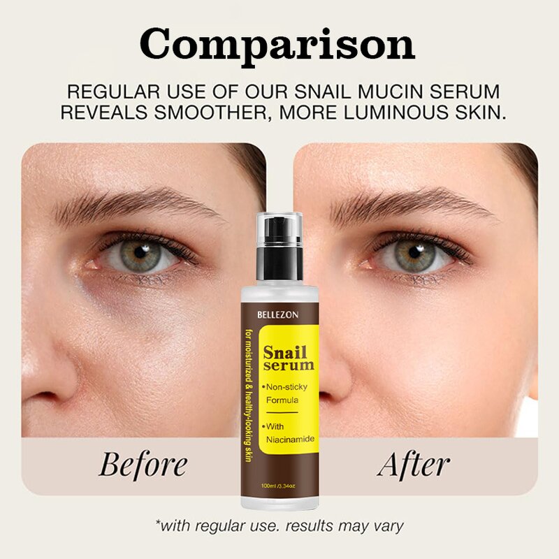 Snail Serum Manufacturer - Mucin Face Skincare Whitening Moisturizing Collagen