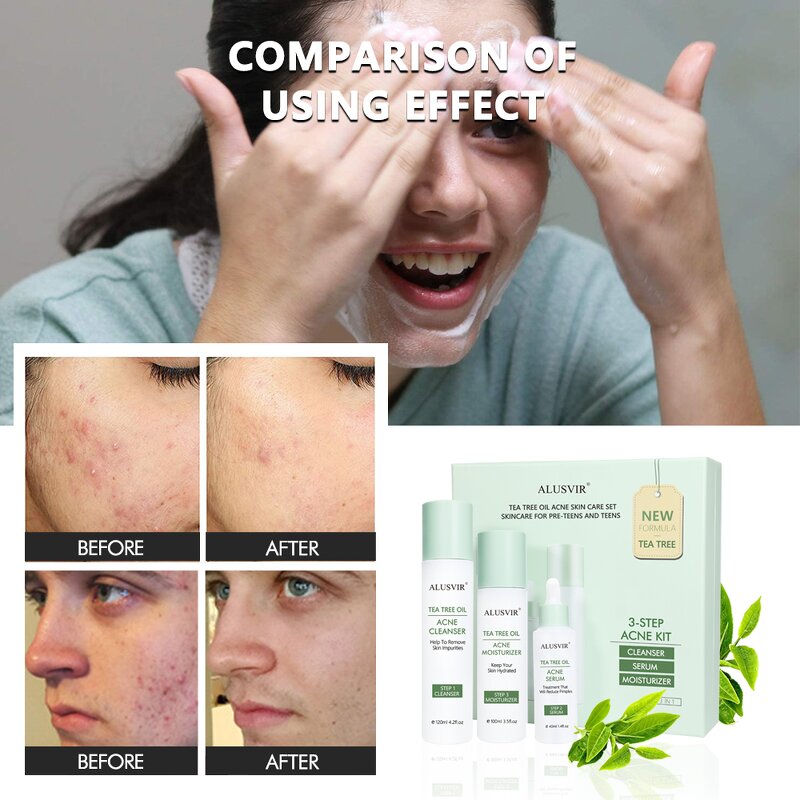 Skincare Set Manufacturer - Anti Acne Korean Natural Organic Tea Tree Moisturizing Facial Set