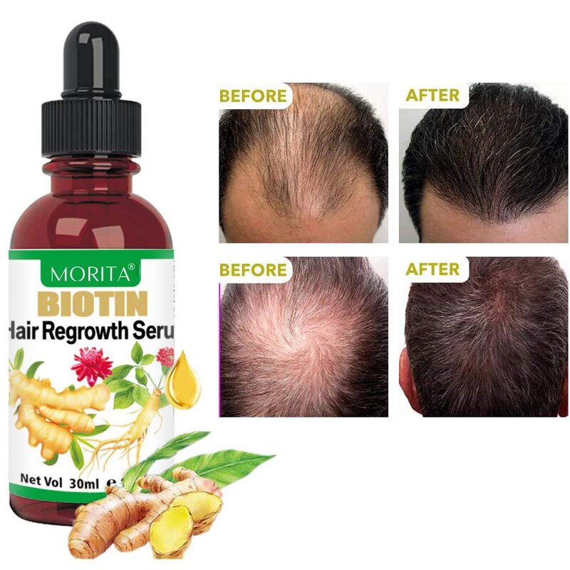 Hair Growth Oil - Manufacturer - Wholesale - Angelica Biotin Ginseng - Roll-on Formula - Hair Regrowth