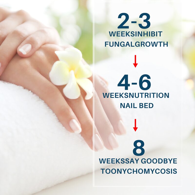 Nail Fungus Removal Cream Manufacturer - Lanthome Onychomycosis Fungal Treatment Paronychia Anti Infection Feet Toe Care