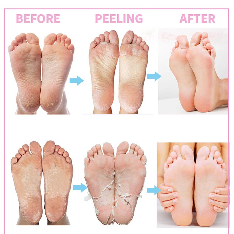 Hand and Body Lotion Manufacturer - Private Label Black Skin Honey Peeling Lightening Whitening Exfoliating for Dark Knuckles