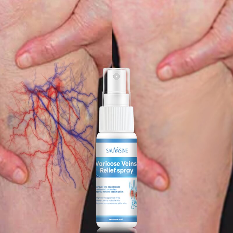 Varicose Veins Spray Manufacturer - Wholesale Hand & Foot Care Relief Spray