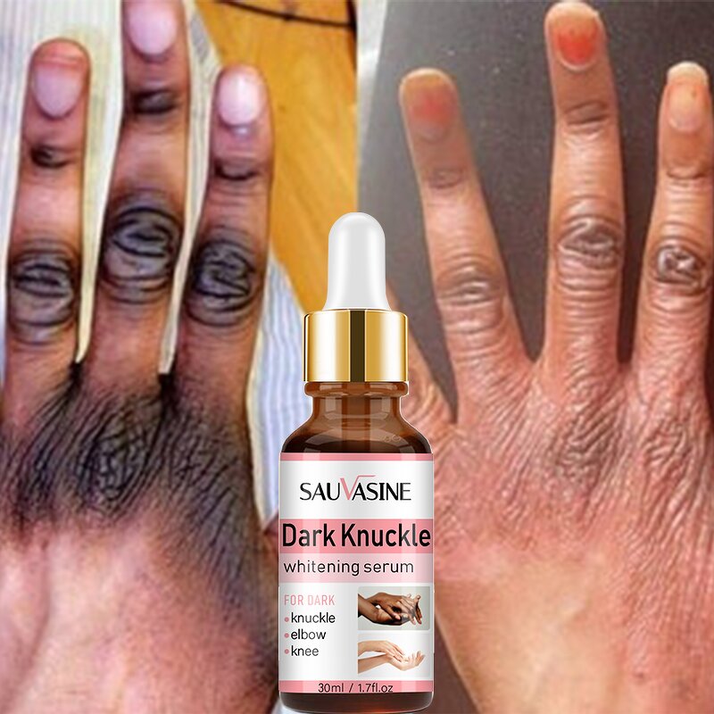 Hand and Body Lotion Manufacturer - Private Label Black Skin Honey Peeling Lightening Whitening Exfoliating for Dark Knuckles