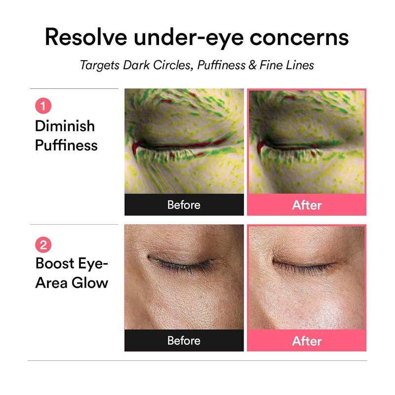 Hydrogel Eye Mask Manufacturer - Private Label PDRN Salmon Reduce Eye Bag Dark Circle Under Pink Gel Gold