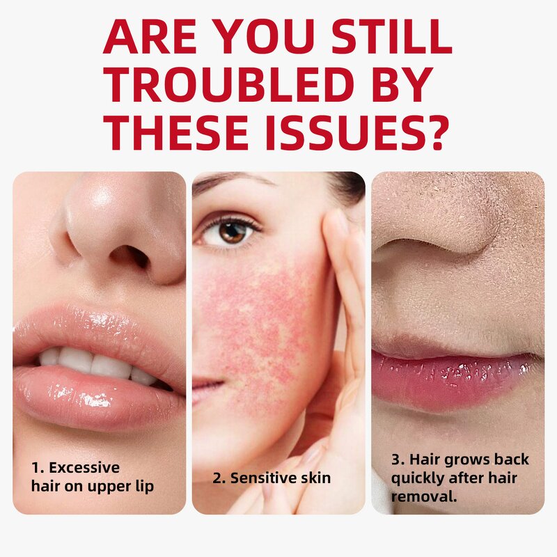 Lip Balm Manufacturer - 2025 Hot Selling Waterproof Honey 5g Deeply Nourishing Moisturizing for Dry Lips