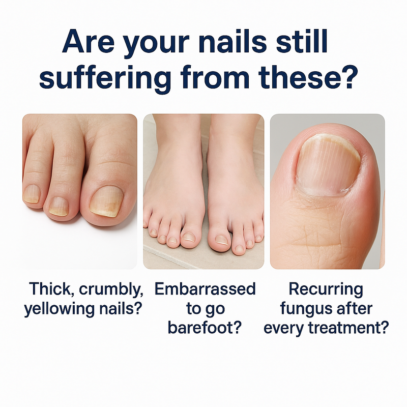 Nail Treatment Pen Manufacturer - Private Label Anti Fungal Repair for Finger Toe Care Nail Fungus Liquid