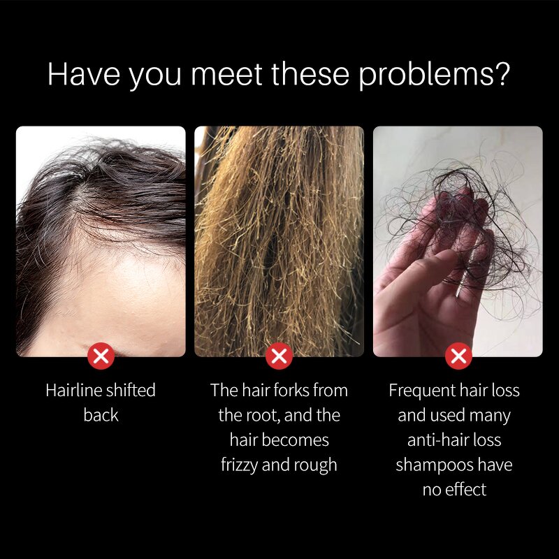 Essential Oil Set Manufacturer - LANTHOME 100% Natural Organic Batana Nourishing Anti-Dandruff for Hair Growth 7 Pieces