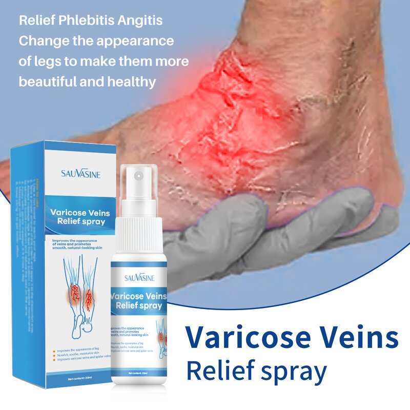 Varicose Veins Spray Manufacturer - Wholesale Hand & Foot Care Relief Spray
