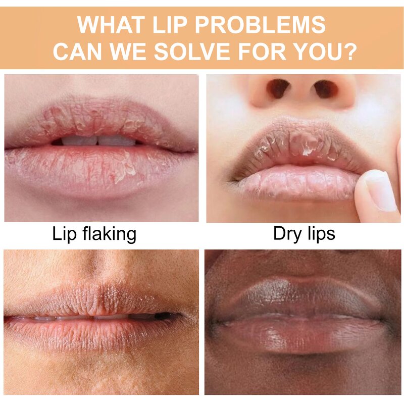 Hair Growth Spray Manufacturer - OEM with Rosemary Oil and Biotin Non-Greasy for Scalp 60ml