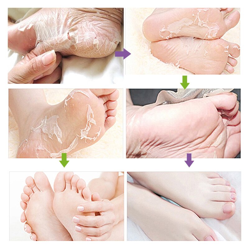 Foot Peel Mask Manufacturer - Private Label Wholesale Moisturizing Exfoliating Coconut Pedicure