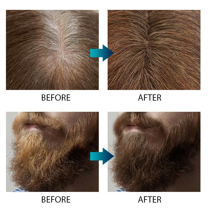 Hair Growth Spray Manufacturer - Lanthome Private Label Best Selling Natural Instant Rice Water for Men