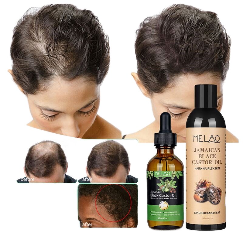 Hair Growth Oil Manufacturer - 100% Natural Hair Loss Eyelash Growth Castor Oil for Hair Care