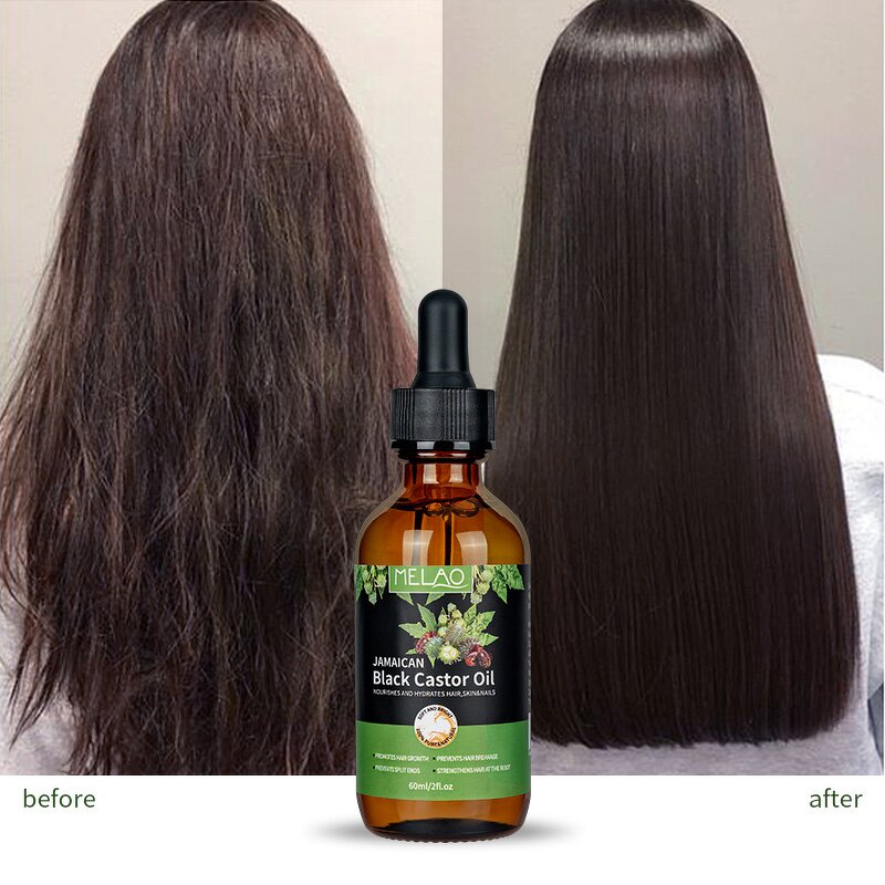 Castor Oil Manufacturer - Jamaica Wholesale Organic for Eye Lash Hair Growth