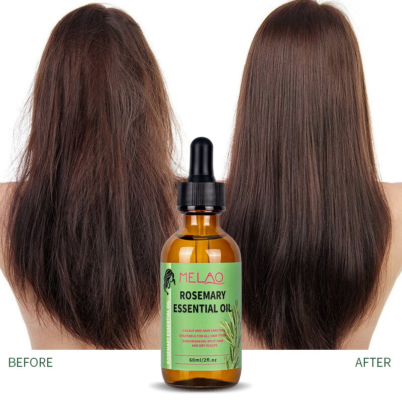 Hair Oil Manufacturer - Custom Logo Natural Rosemary Oil for Hair Growth Treatment