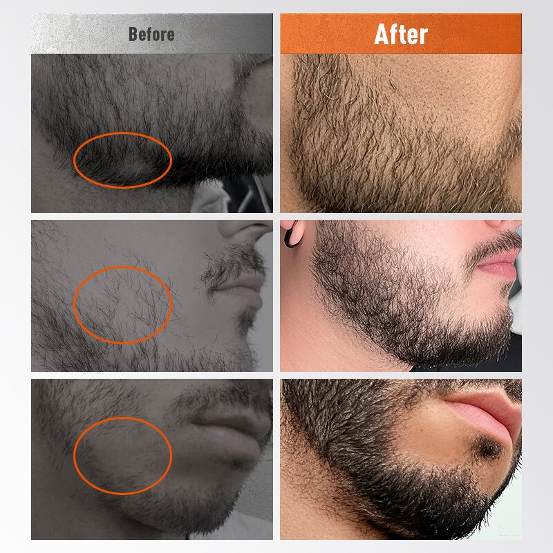 Beard Set Manufacturer - Private Label Luxury Grow Set Serum Roller with Bag Men Grooming