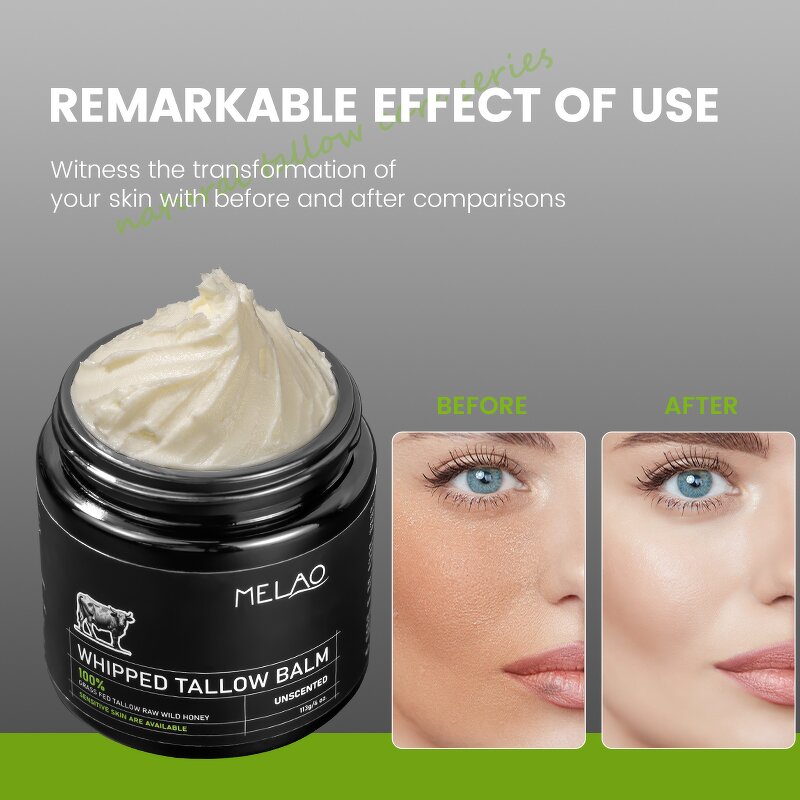 Beard Balm Manufacturer - Custom Logo Organic Beef Tallow for Men Pimples Oil Skin Care Set