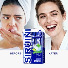 Mouthwash Strips Manufacturer - Custom Logo Vegan Portable 30s Oral Care No Rinse Travel Kit