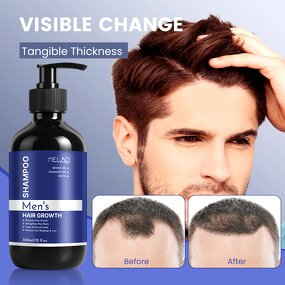 Hair Growth Shampoo Manufacturer - Private Label Vegan Biotin for Thinning Hair Regrowth