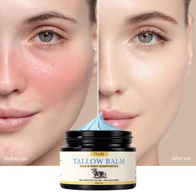 Beef Tallow Balm Manufacturer - Custom 3 Ingredient Grass Fed Handmade Honey Whipped Balm